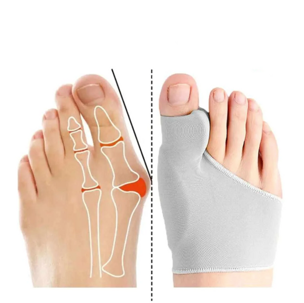 Correcteur Chaussette Hallux Valgus